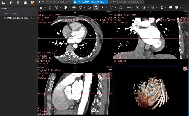 小赛看看dicom viewer医学影像软件截图1