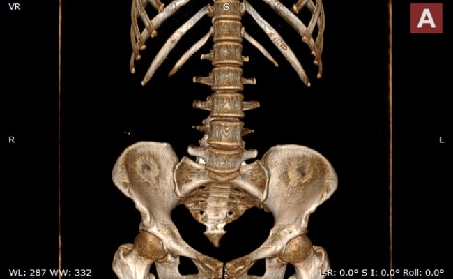 小赛看看dicom viewer医学影像软件截图2