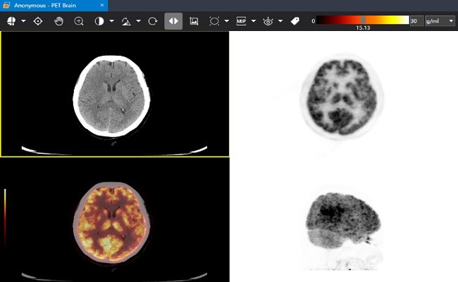 小赛看看dicom viewer医学影像软件截图3