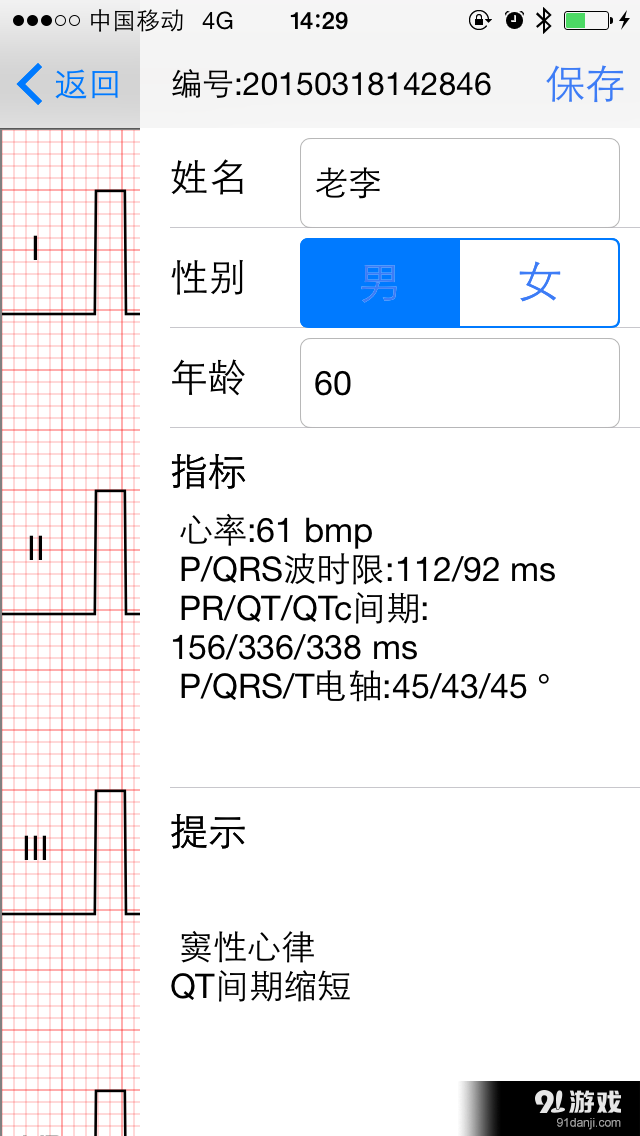 好朋友心电图v2.3.12截图4