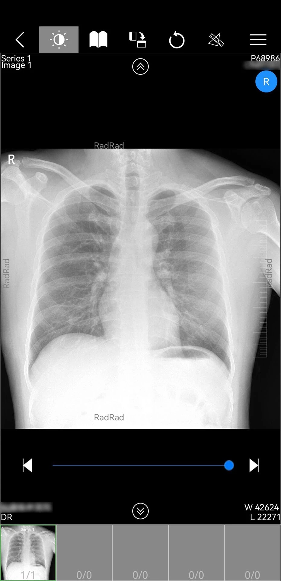 微影医生纯净版v1.18.110截图1