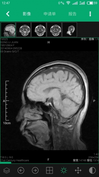 21云影像v2.5.9截图3