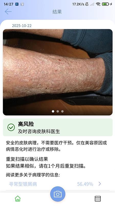 医用皮肤镜影像处理软件安卓版v1.0.0截图4