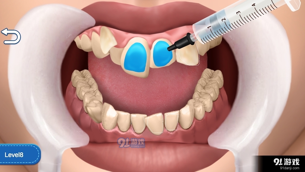 清洁牙齿狂热v1005截图3