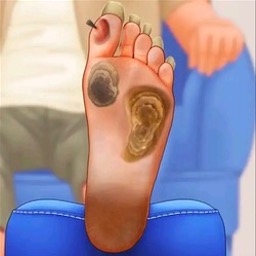 修脚足疔模拟器测试版v1.0