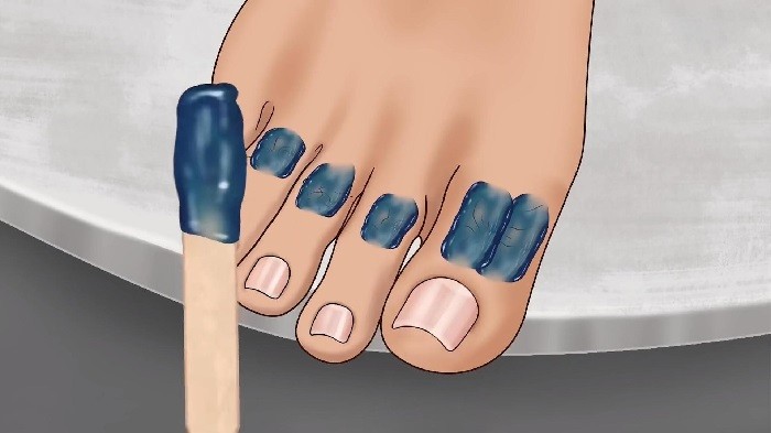 修脚足疔模拟器测试版v1.0截图2