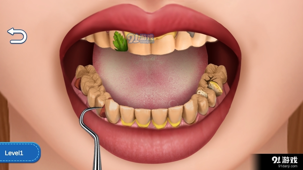 清洁牙齿狂热v1005截图2