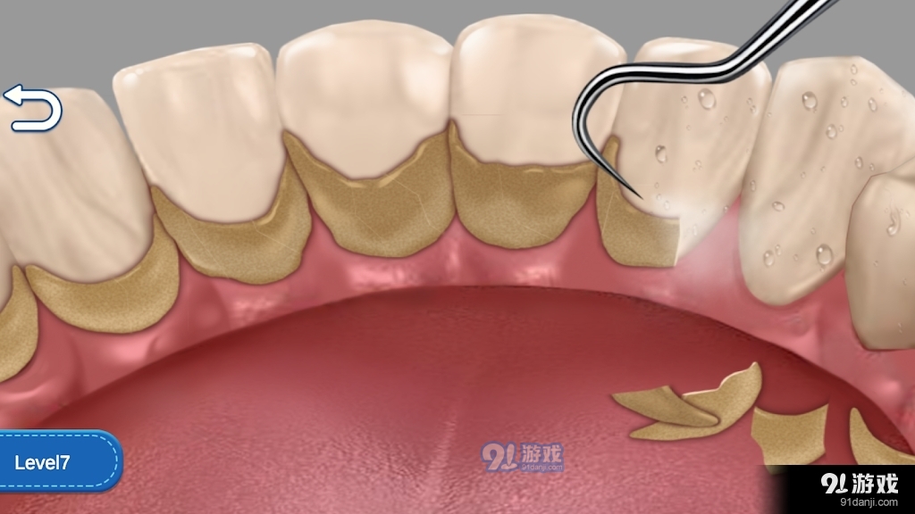 清洁牙齿狂热v1005截图1
