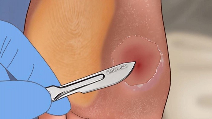 修脚足疔模拟器汉化版v1.0截图3