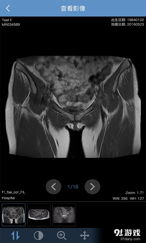 汇医慧影v2.3.9截图3