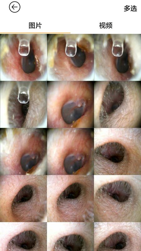 蜂鸟采耳v4.5.11截图3