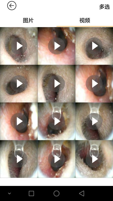 蜂鸟采耳v4.5.11截图4