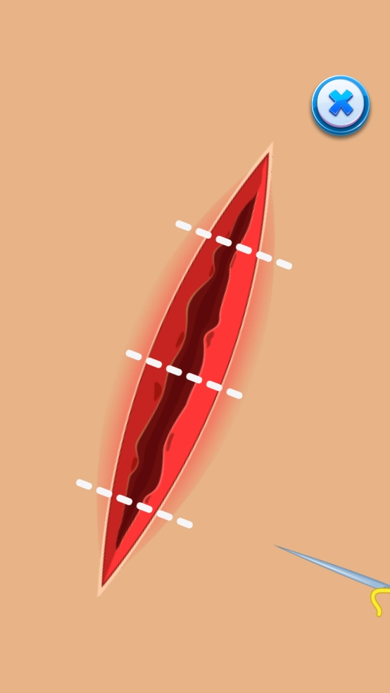 足部医生游戏(FootDoctor)截图1