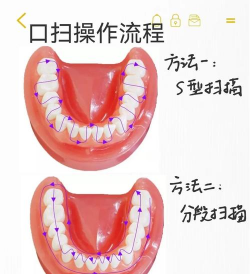 口腔病的游戏怎么玩，了解玩法规则，掌握操作技巧